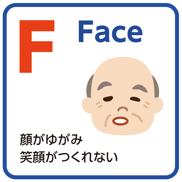 Face：顔がゆがみ笑顔がつくれない。