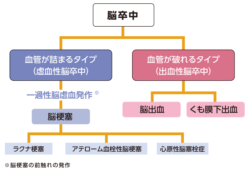 脳卒中の種類を表した図。