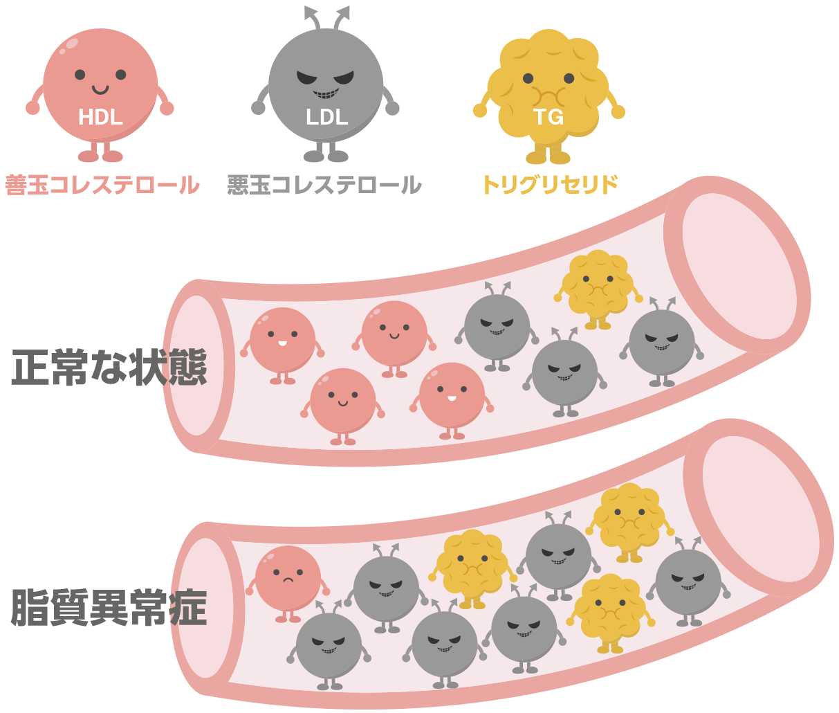 脂質異常症