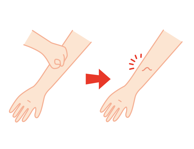 皮膚をつまんでもすぐに戻らなければ脱水。