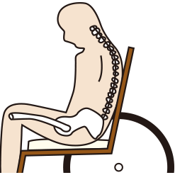 円背（背中が前に丸まった姿勢）