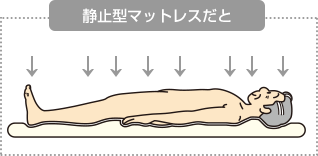 静止型マットレスだと一定箇所にかかる圧迫力（あっぱくりょく）が小さい